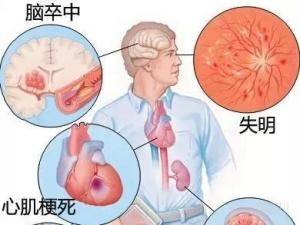高血压的危害